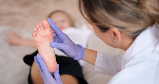 Boala gură mână picior: care sunt simptomele și cum se tratează afecțiunea?